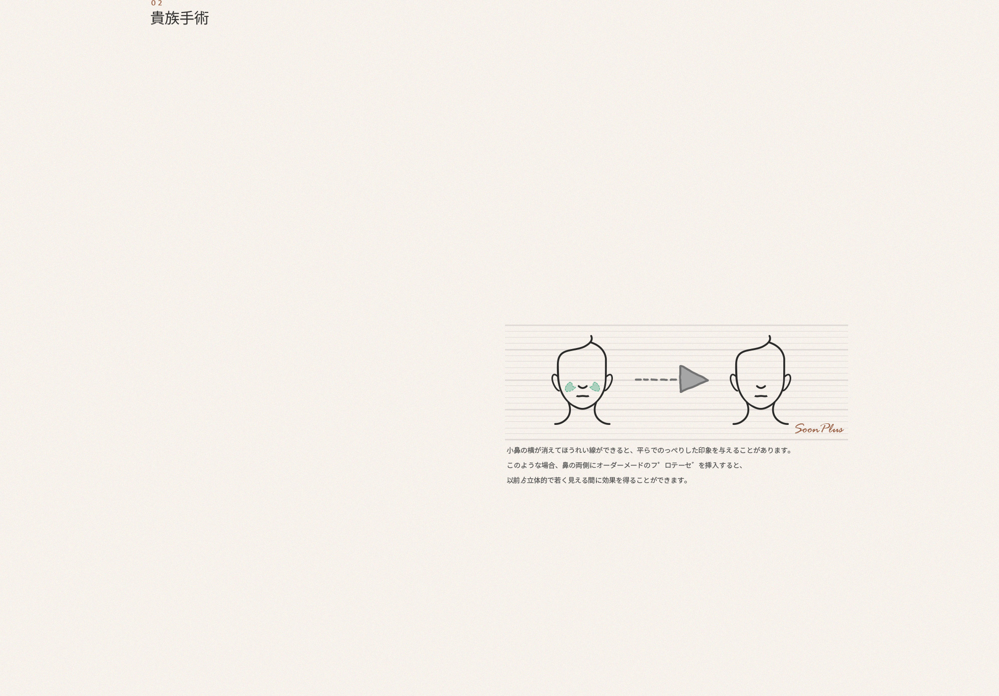02 귀족수술