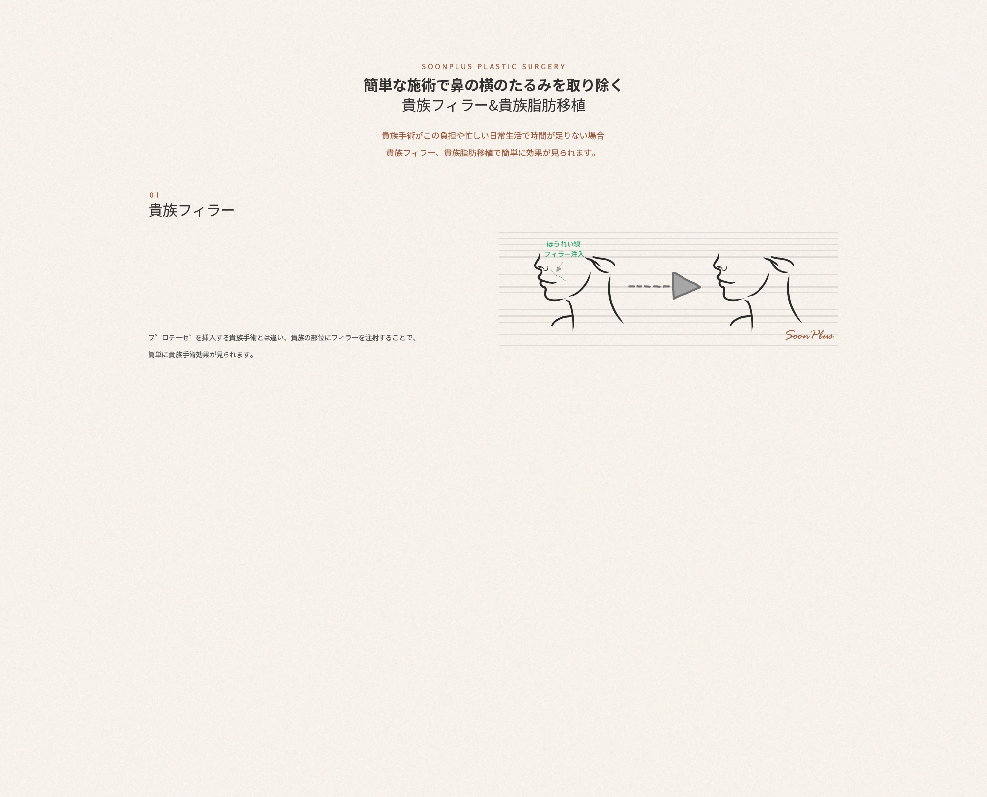 01 귀족 필러