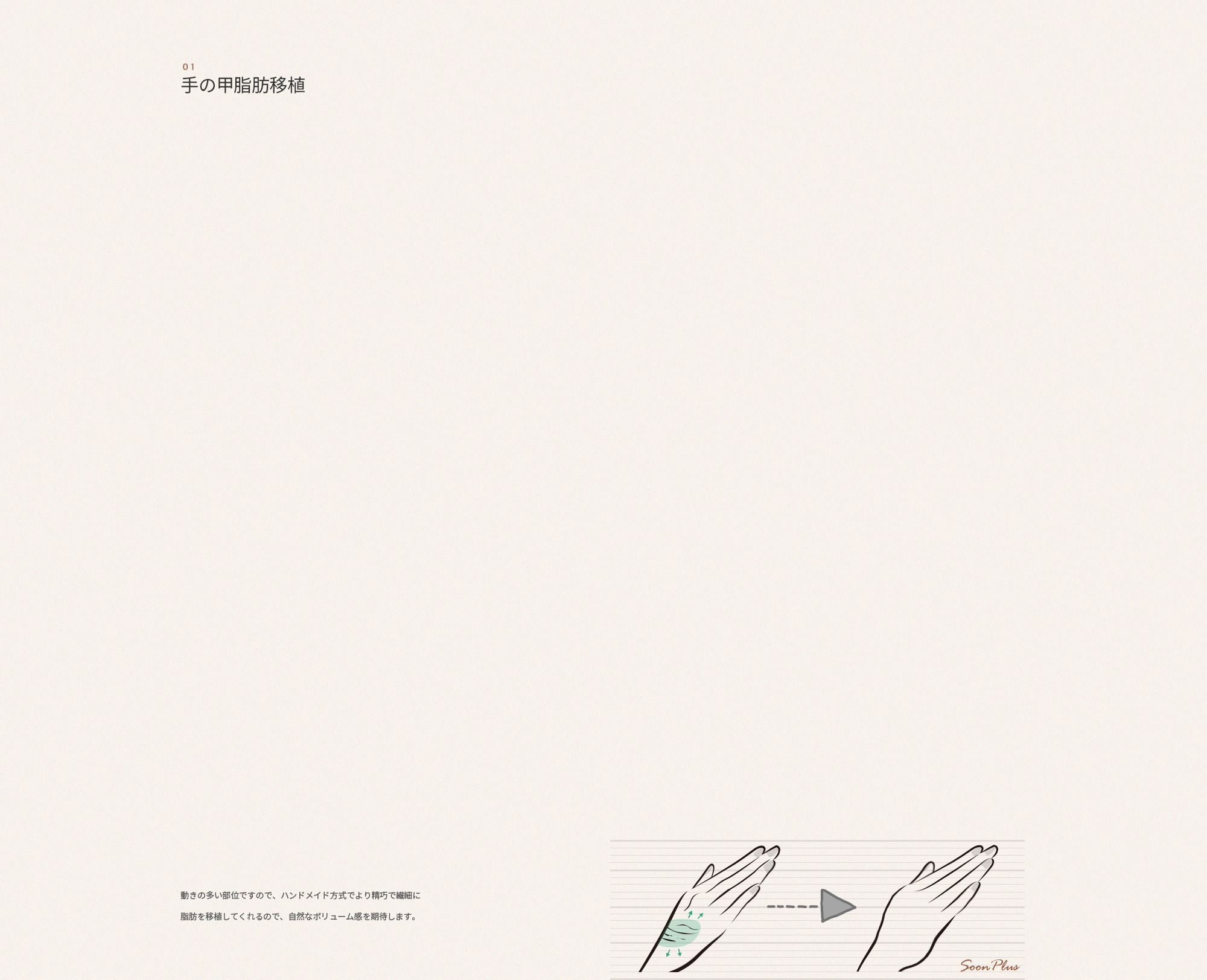 얼굴지방이식