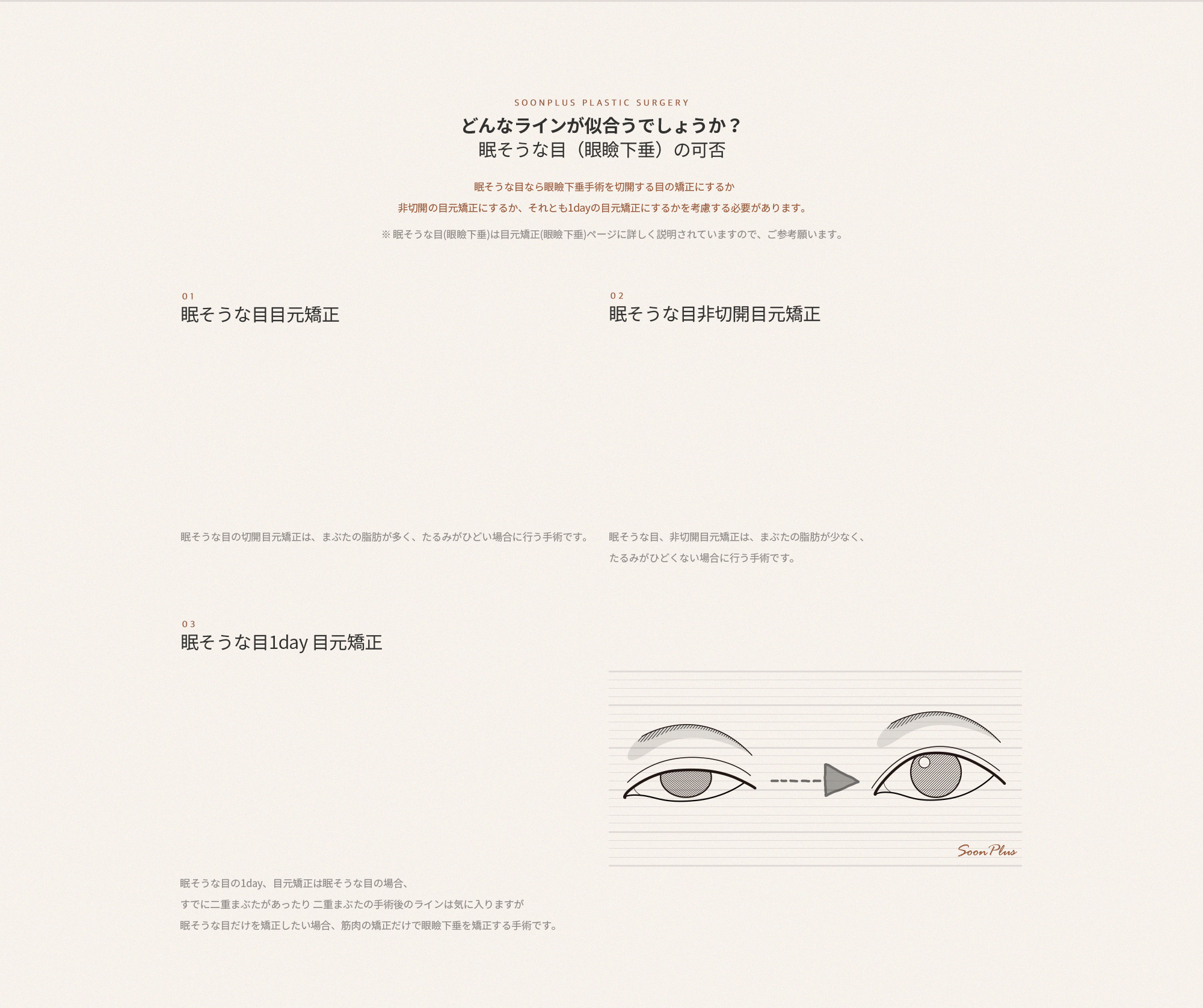 졸린눈(안검하수)의 여부