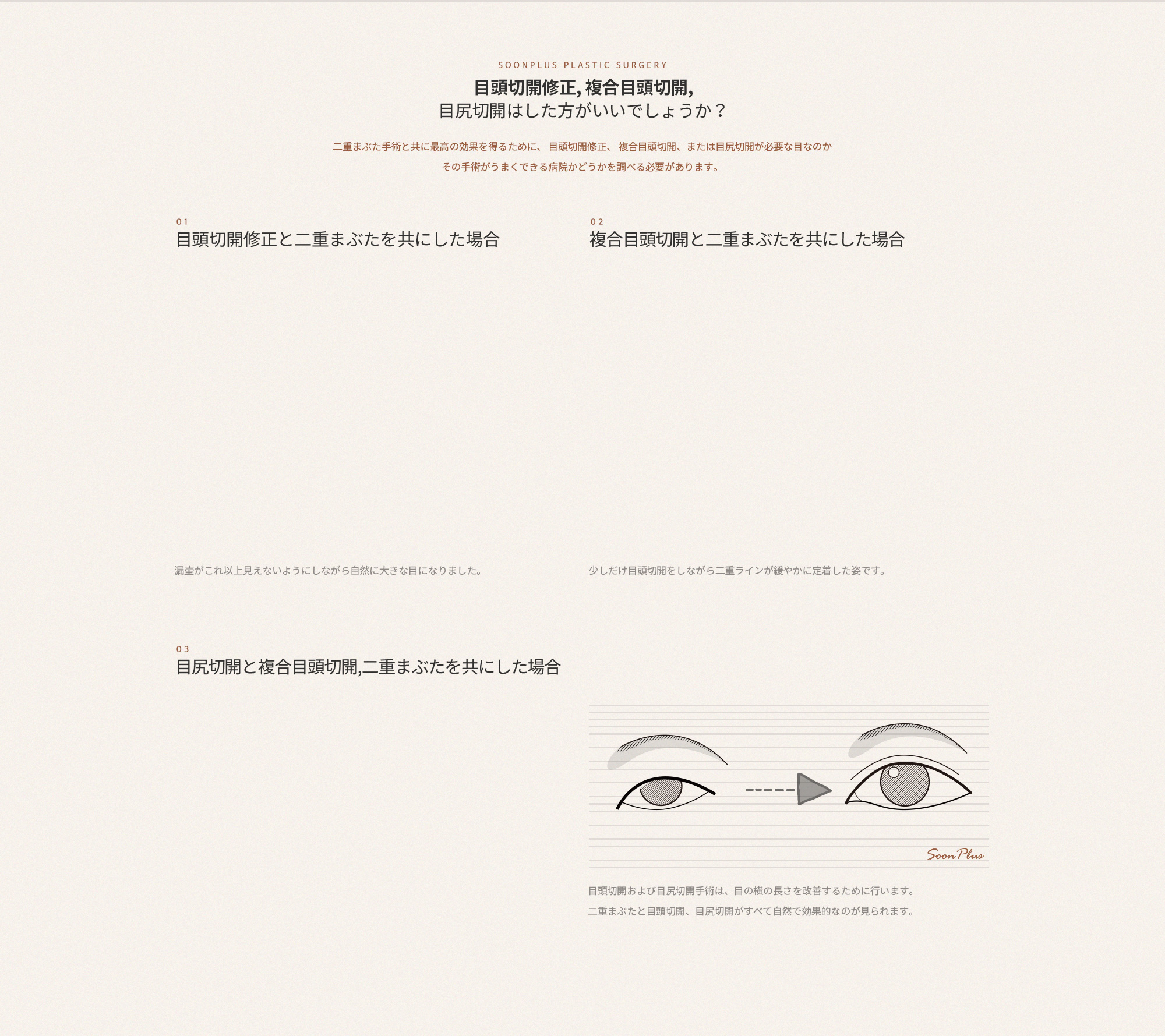 제자리트임, 복합앞트임, 뒤트임은 하는 것이 좋을까?