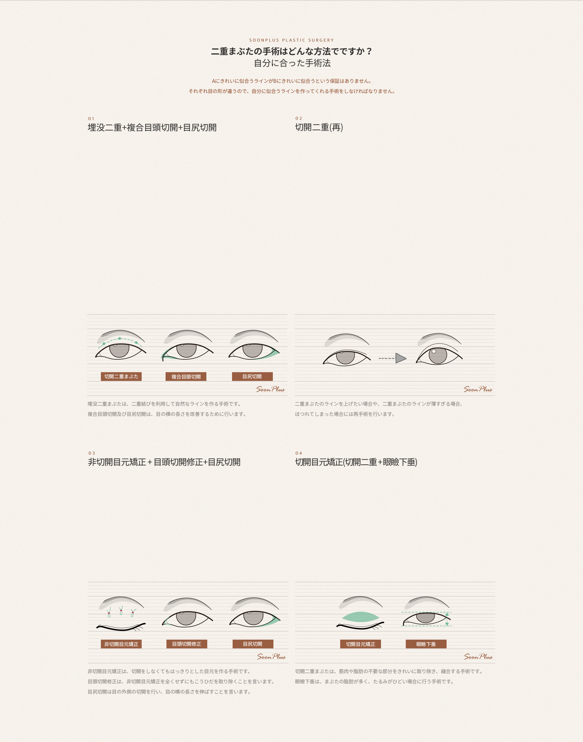 나에게 맞는 수술법