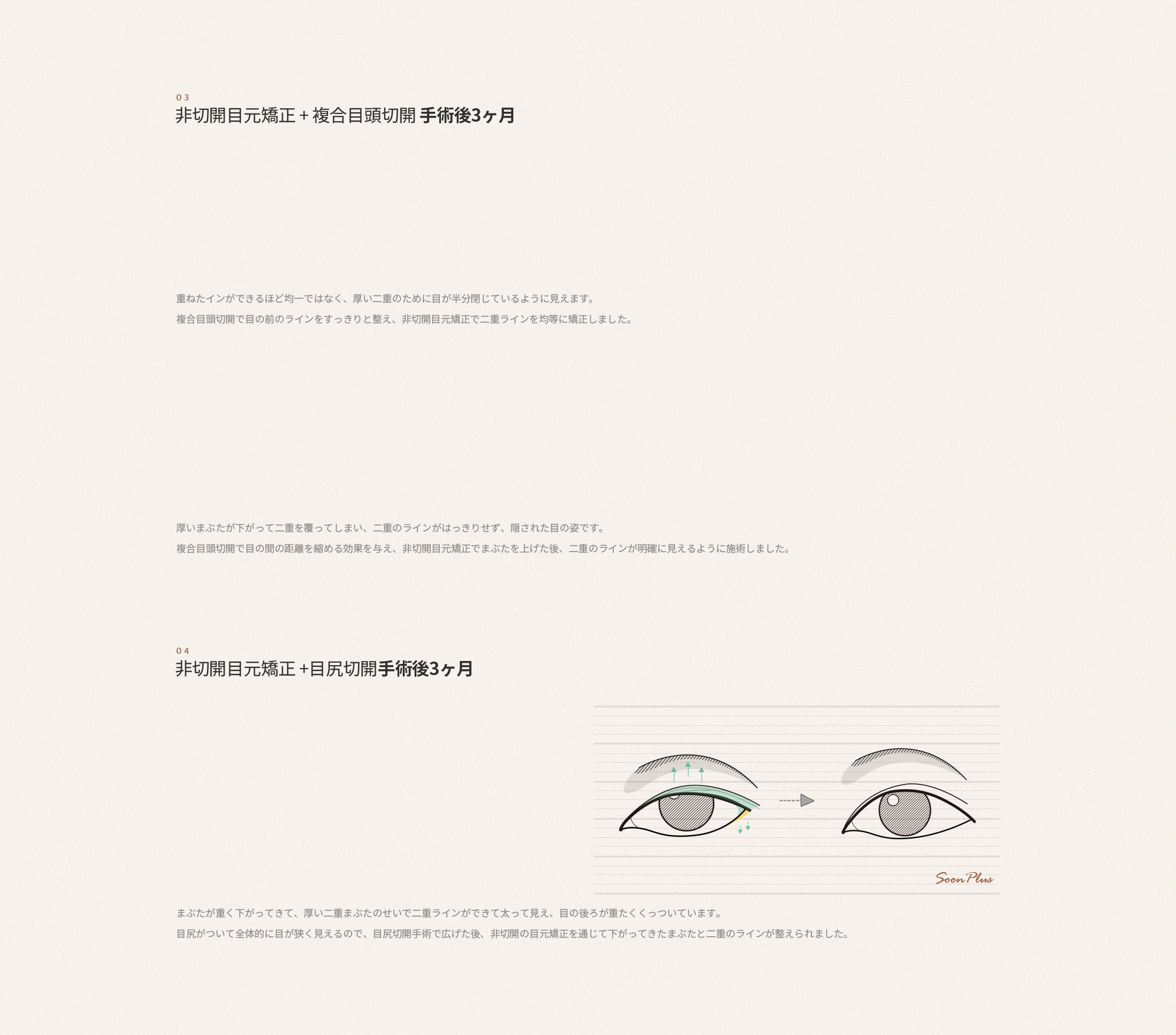 sub_1