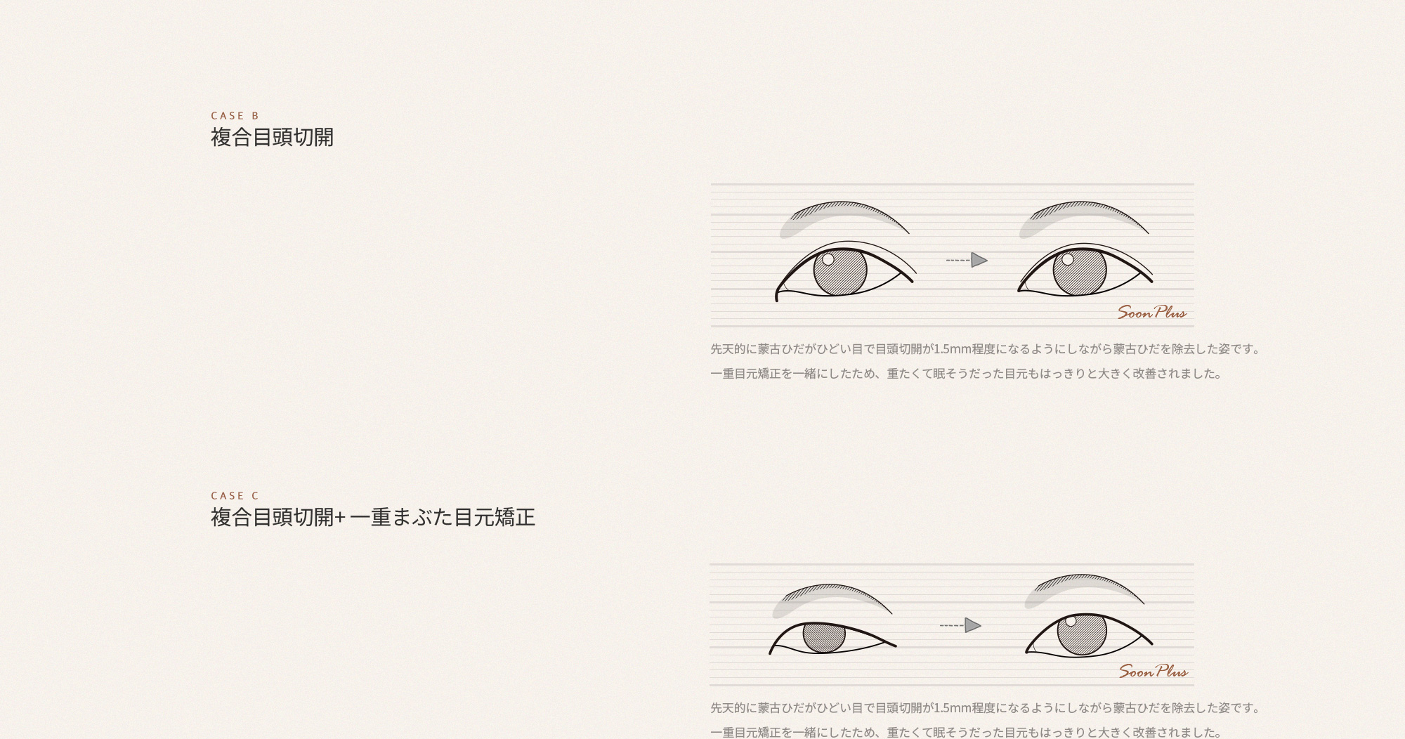 sub_1