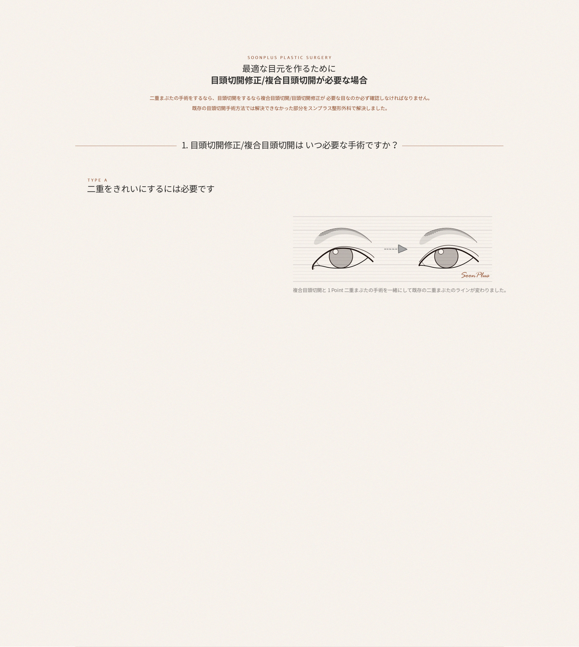 sub_1
