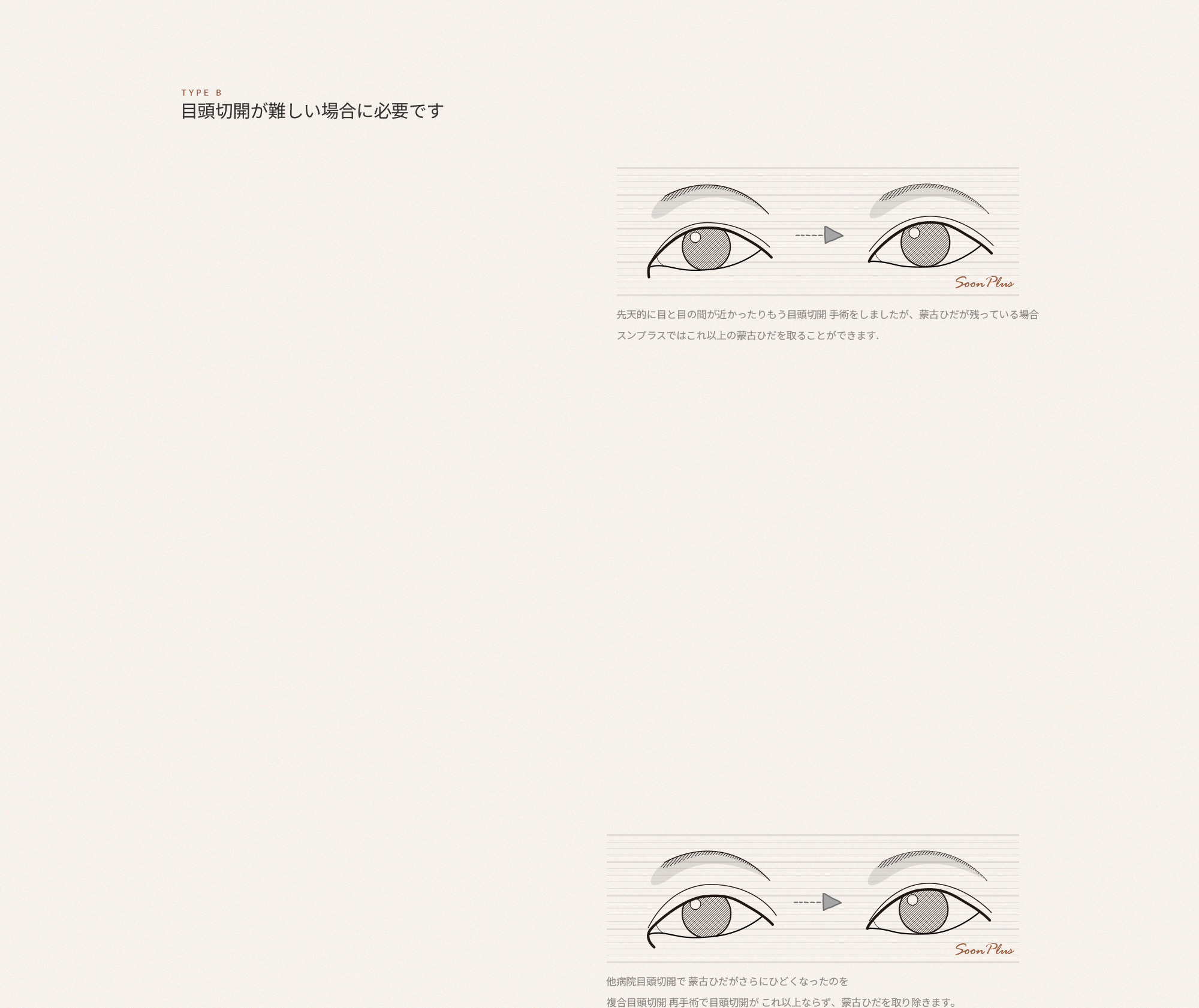 sub_1
