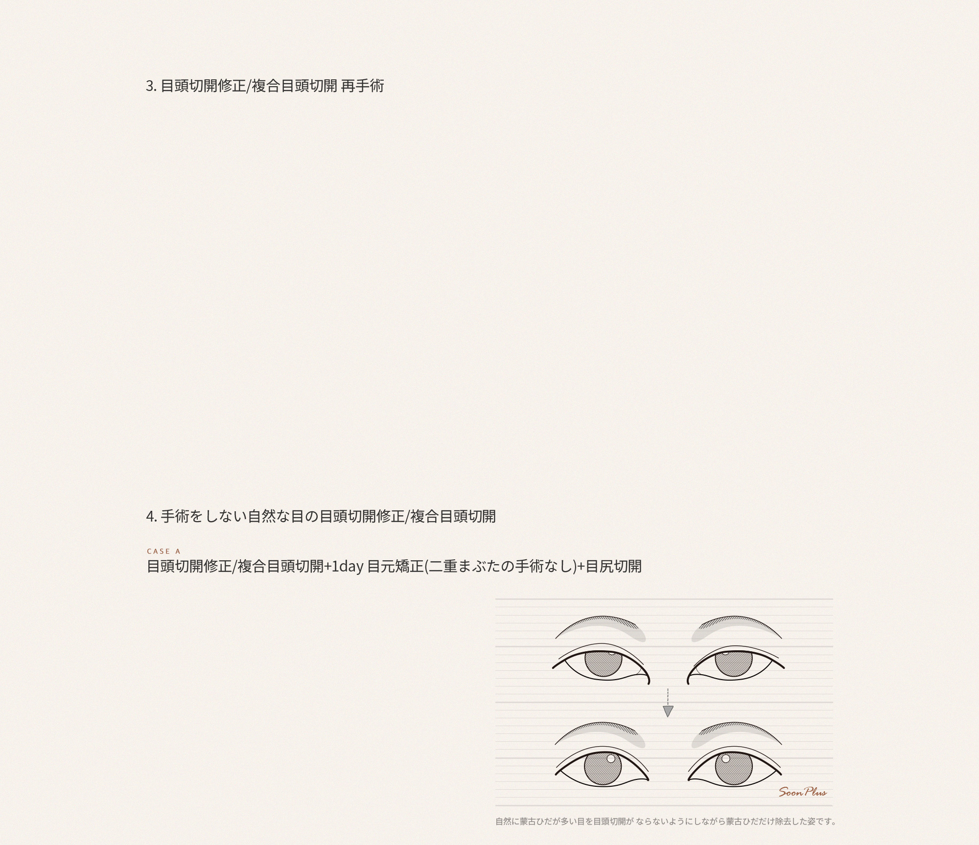 sub_1