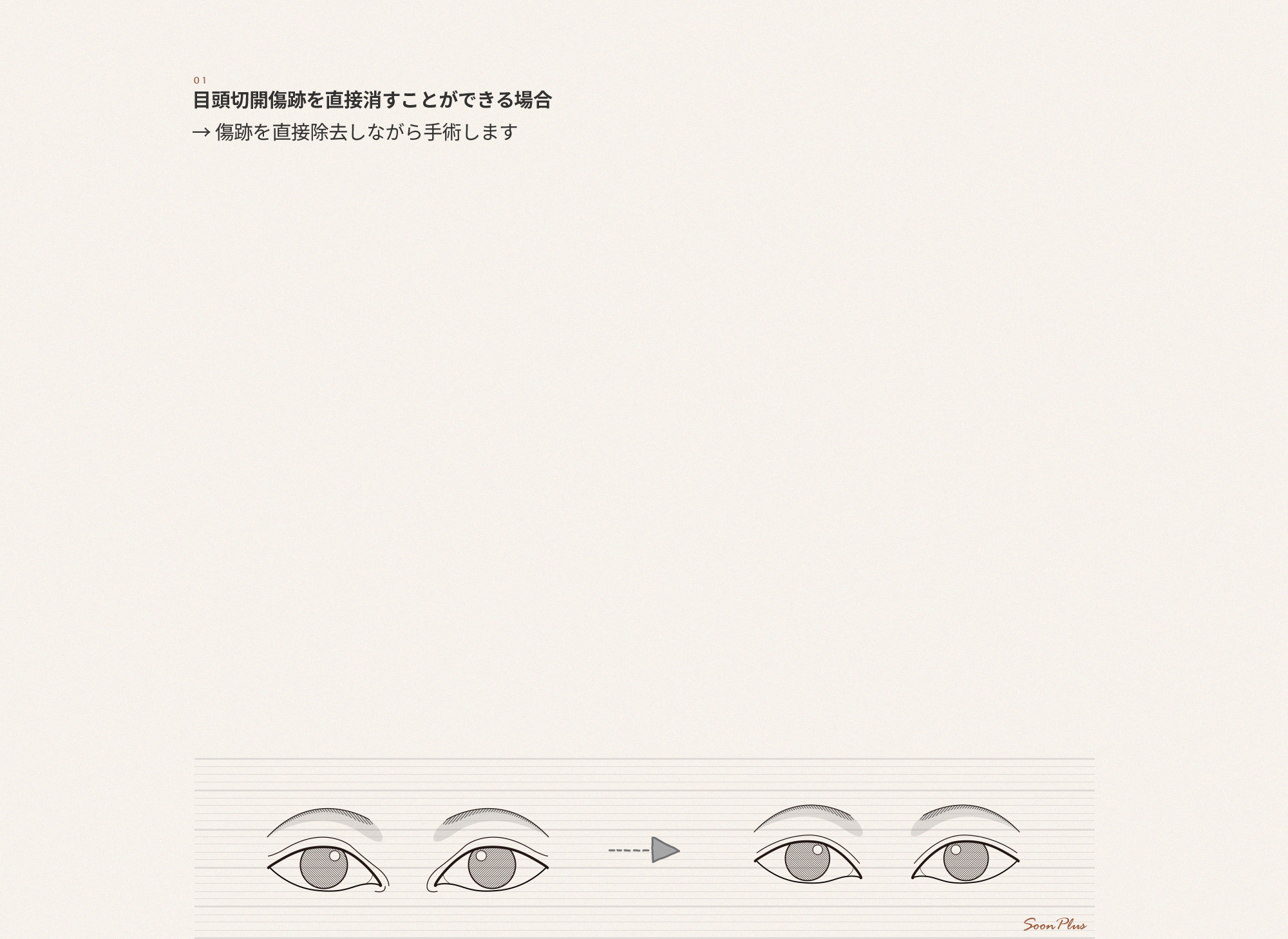sub_2