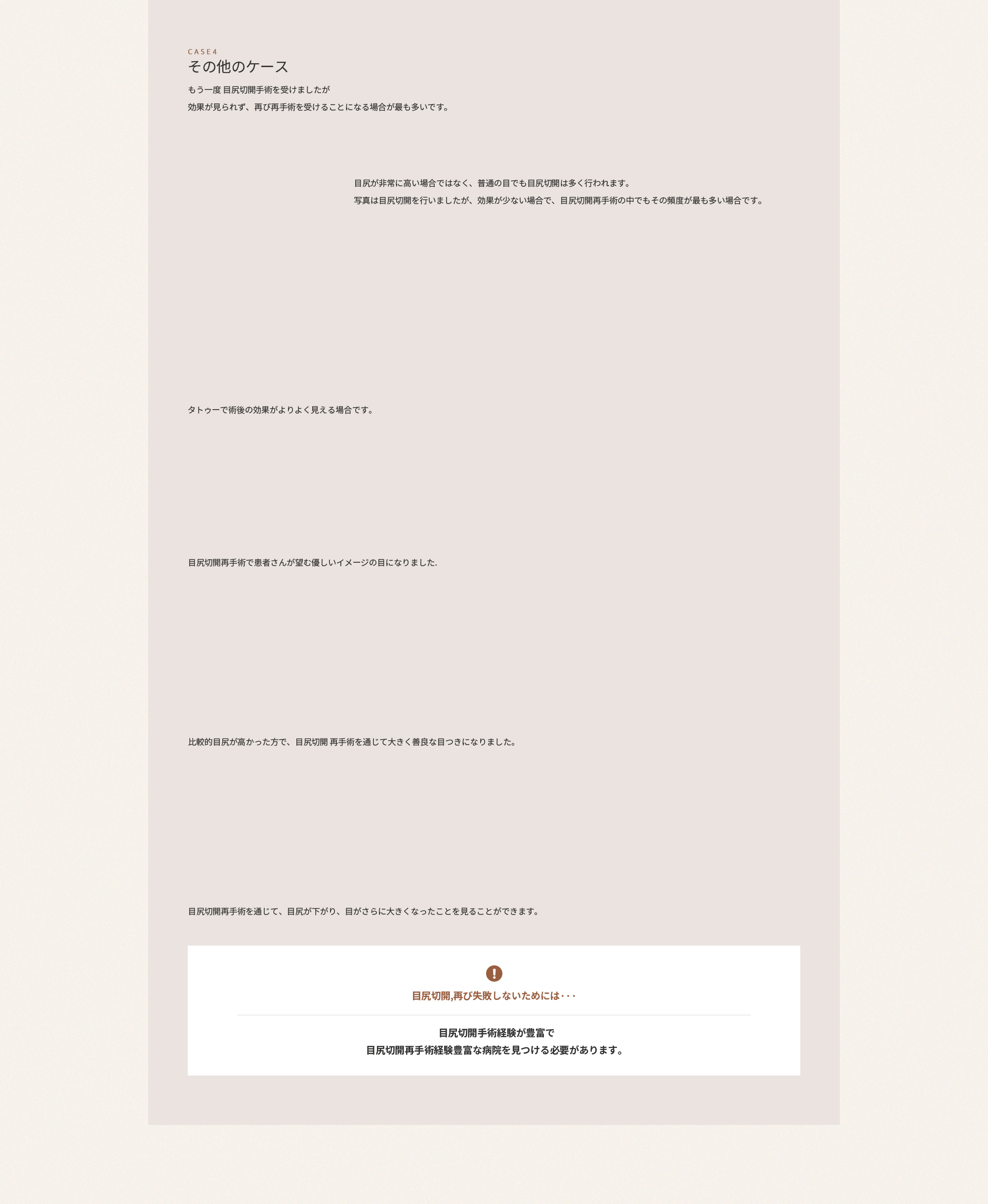뒤트임, 다시 실패하지 않으려면... 뒤트임수술 경험이 풍부하고 뒤트임재수술 경험이 풍부한 병원을 찾아야합니다.