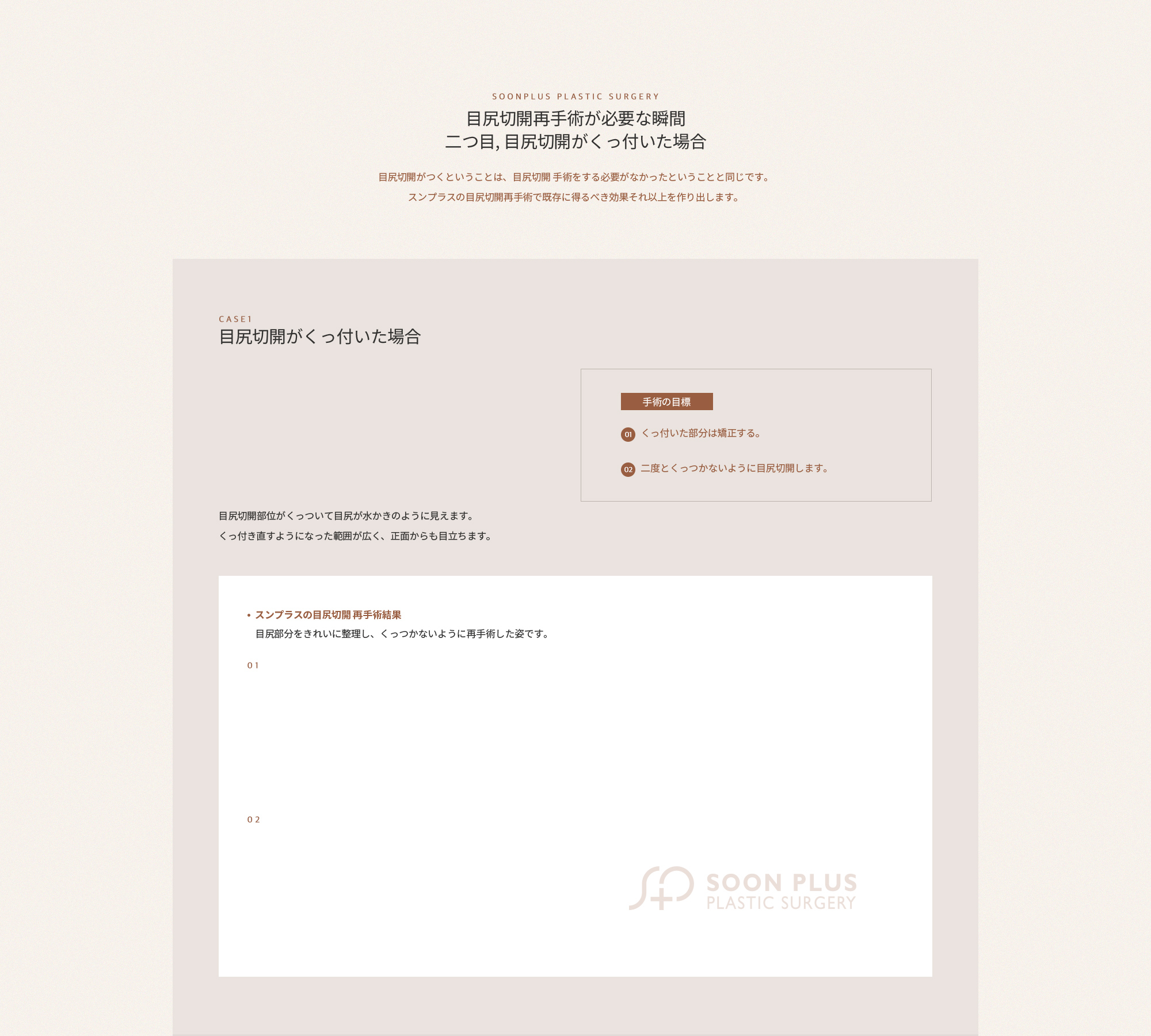 두번째, 뒤트임이 붙어버린 경우