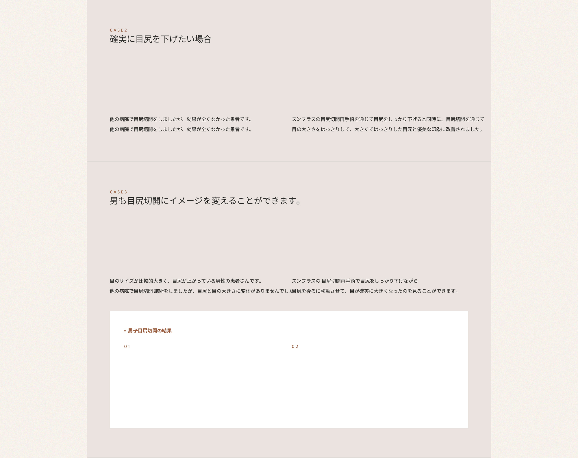 뒤트임 재수술은 이미 수술을 받았던 부위를 재수술 하기 때문에 첫수술보다 난이도가 높습니다.