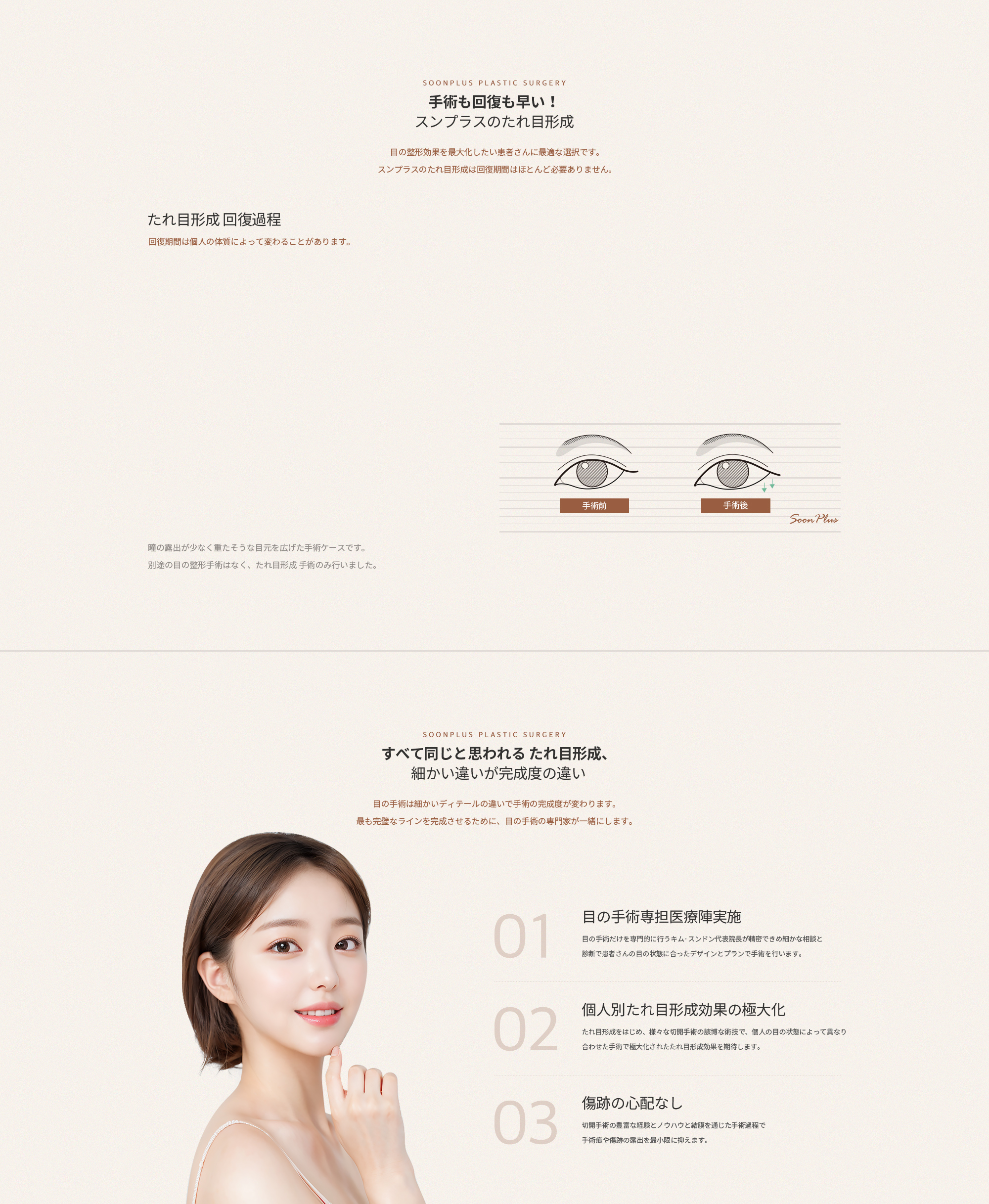 수술도 회복도 빠른! 순플러스의 밑트임