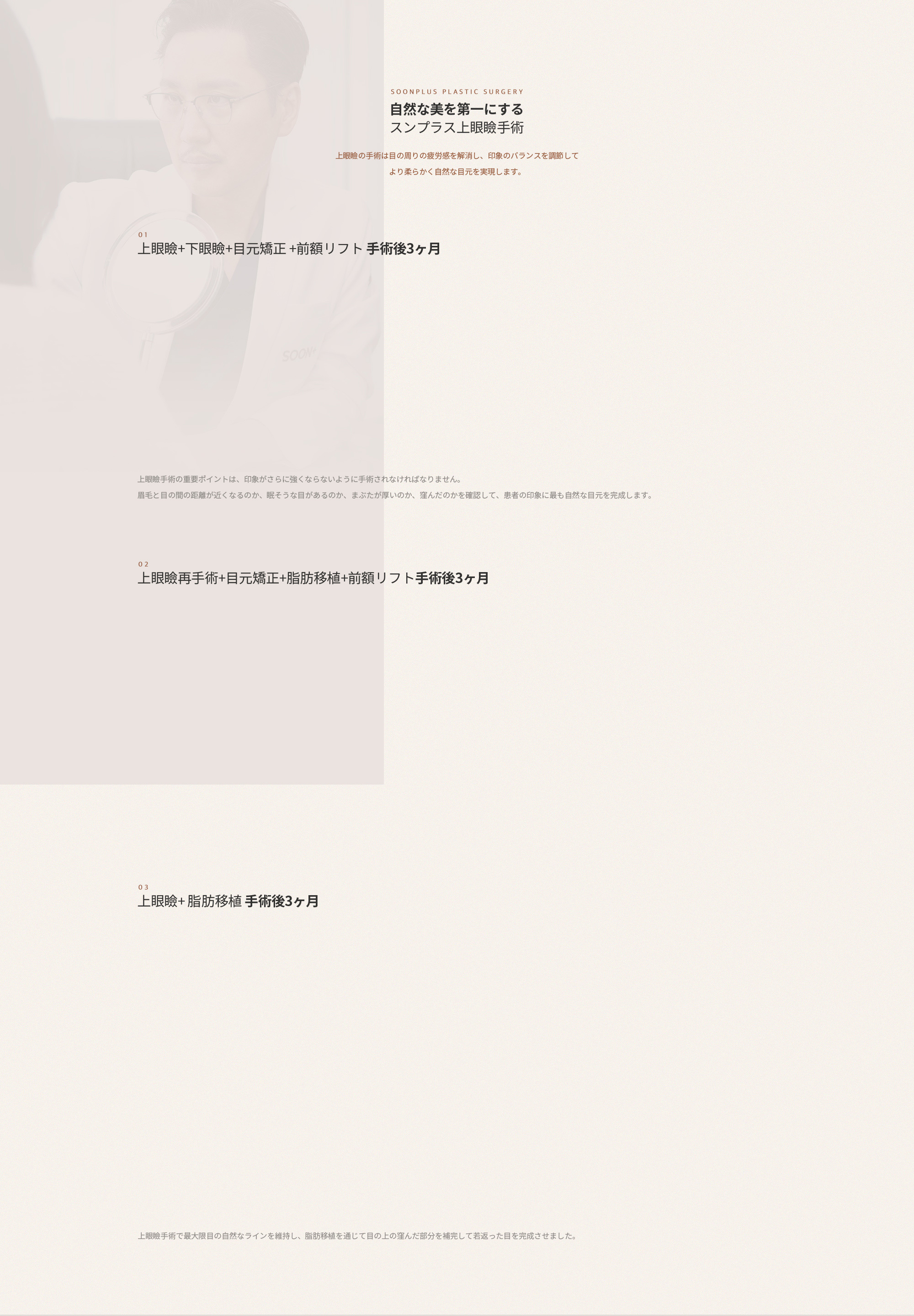 자연스러운 아름다움을 우선시한 순플러스의 상안검 수술