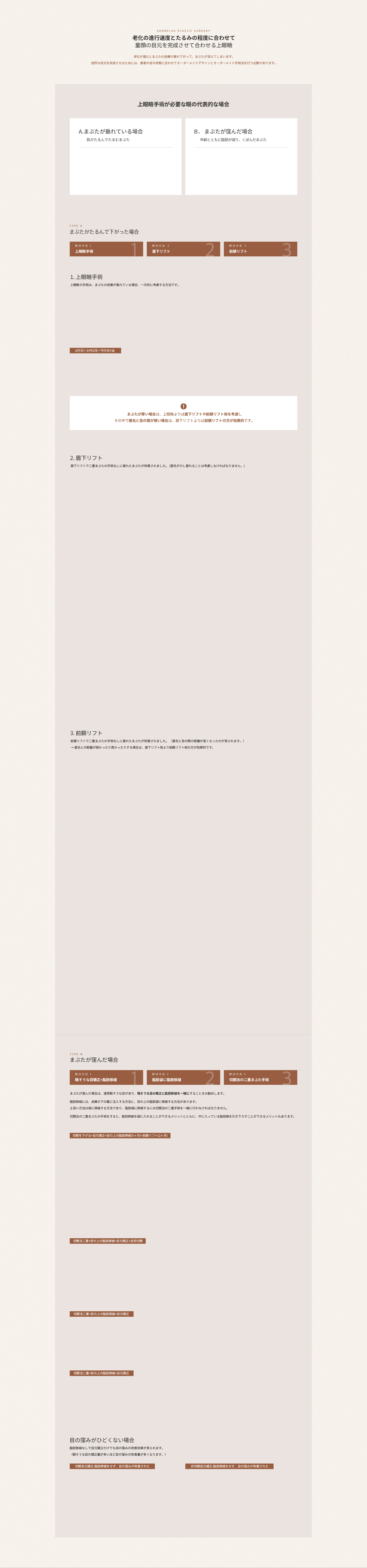 노화의 진행 속도와 처짐 정도에 맞게 동안 눈매를 완성하는 맞춤 상안검