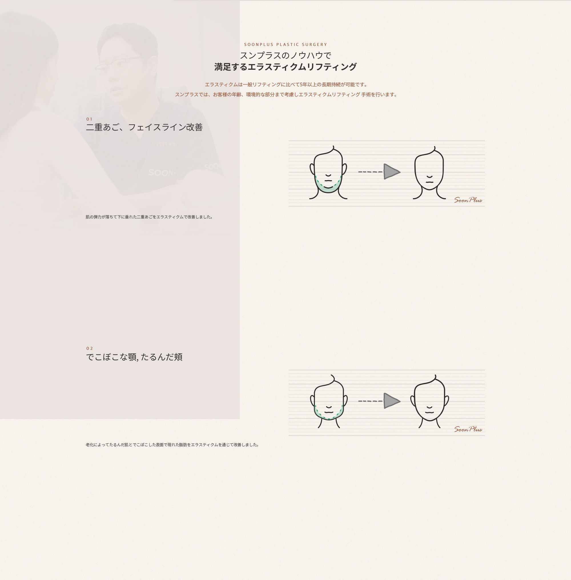순플러스의 노하우로 만족스러운 엘라스티꿈 리프팅