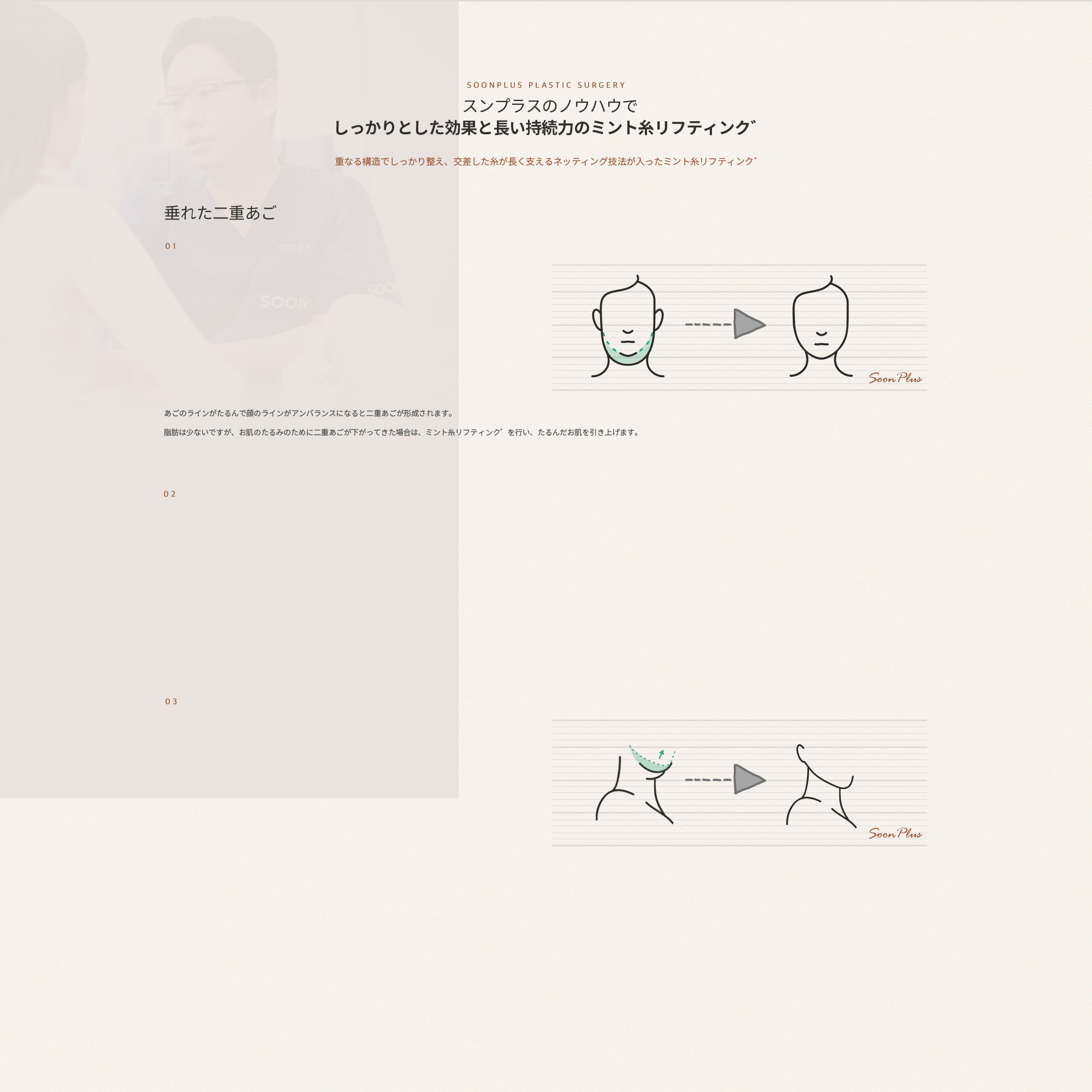 순플러스의 노하우로 탄탄한 효과와 긴 지속력의 민트실리프팅