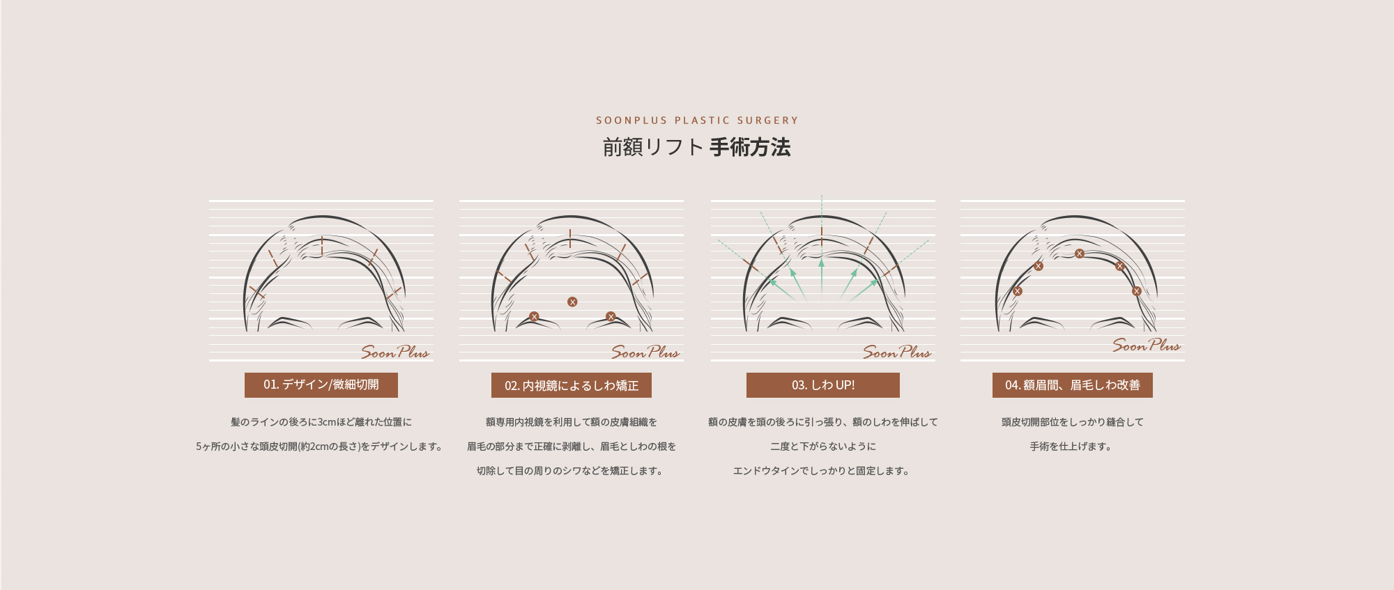 이마거상