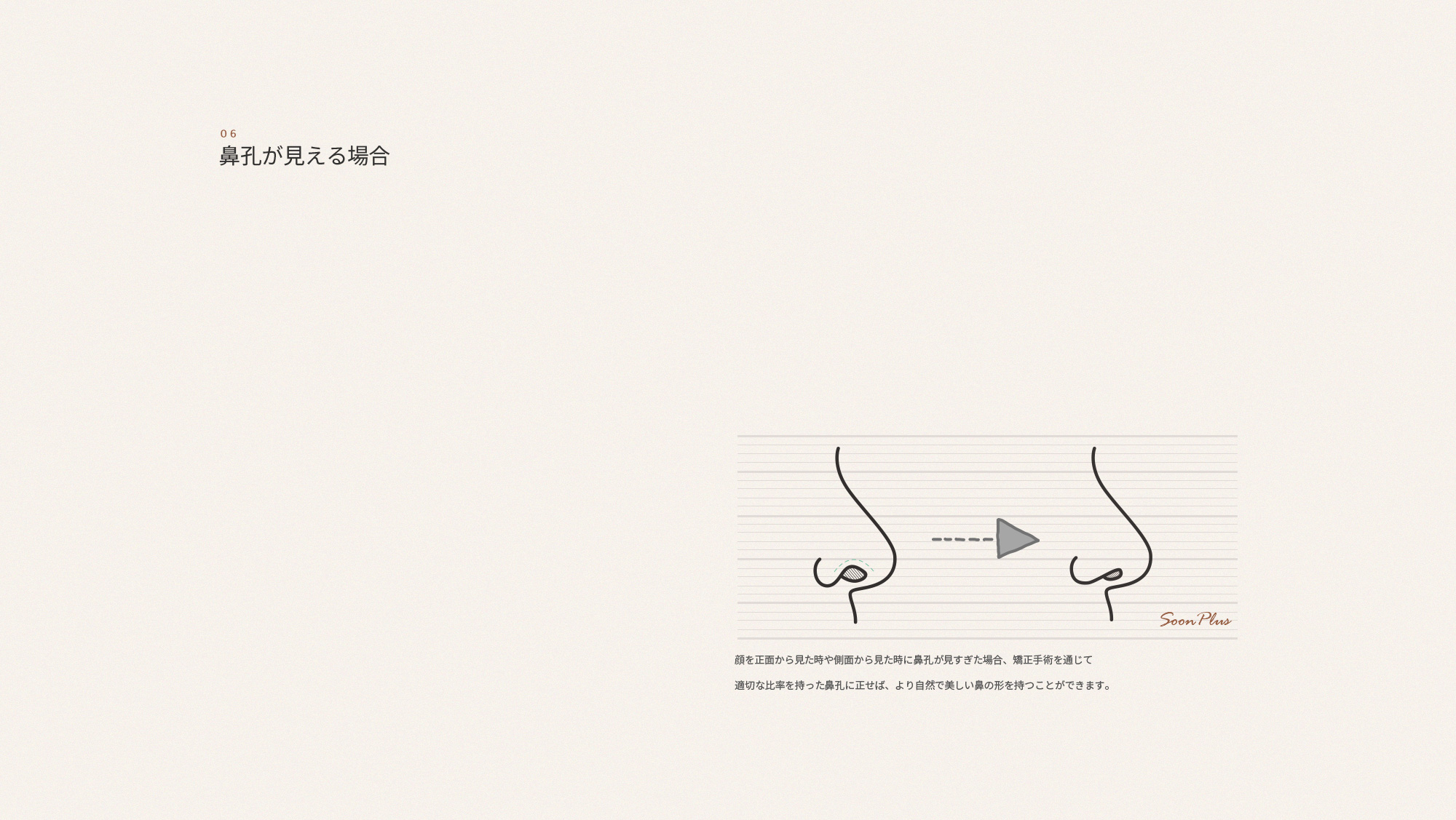 06 콧구멍이 보이는 경우