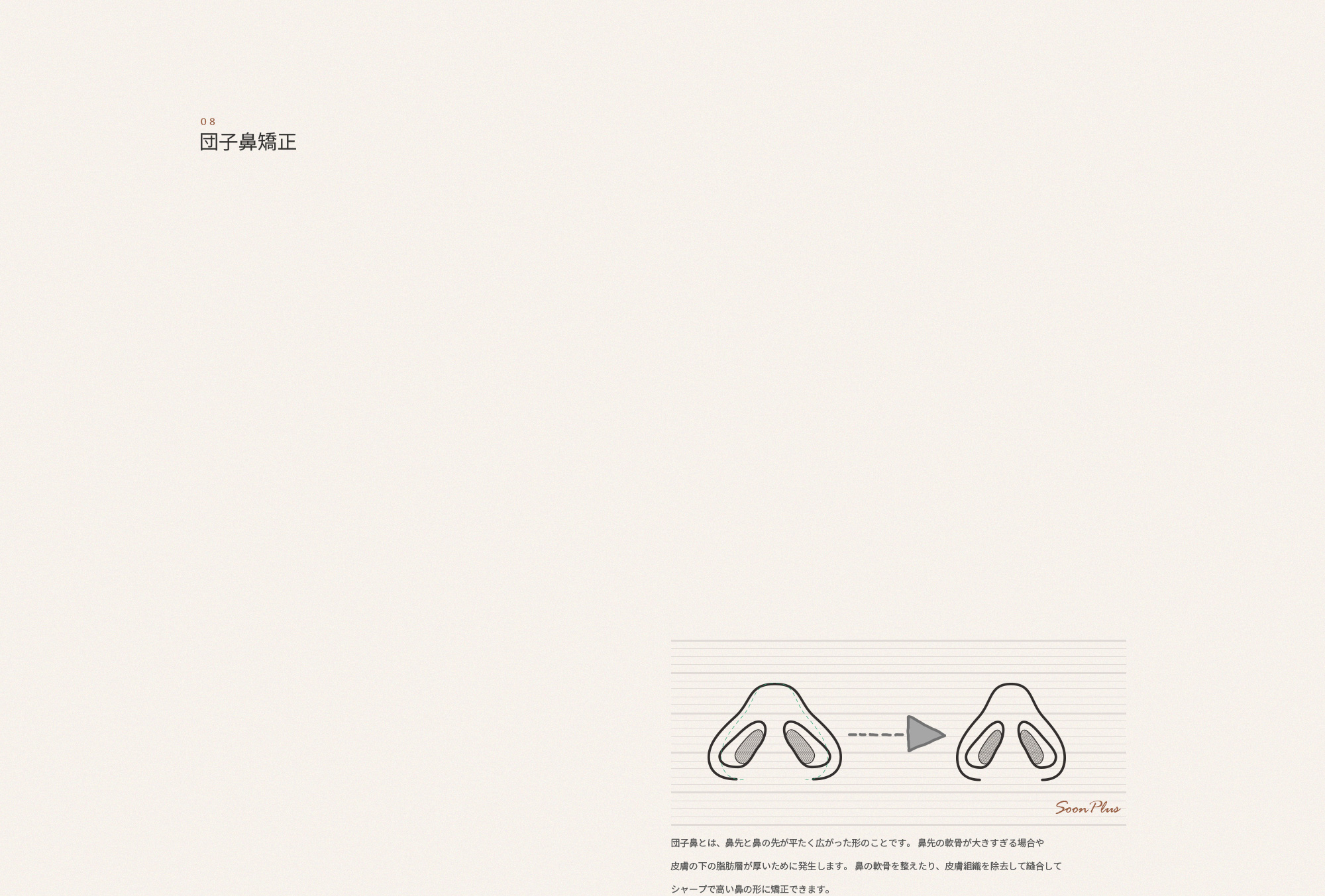 08 복코 교정술