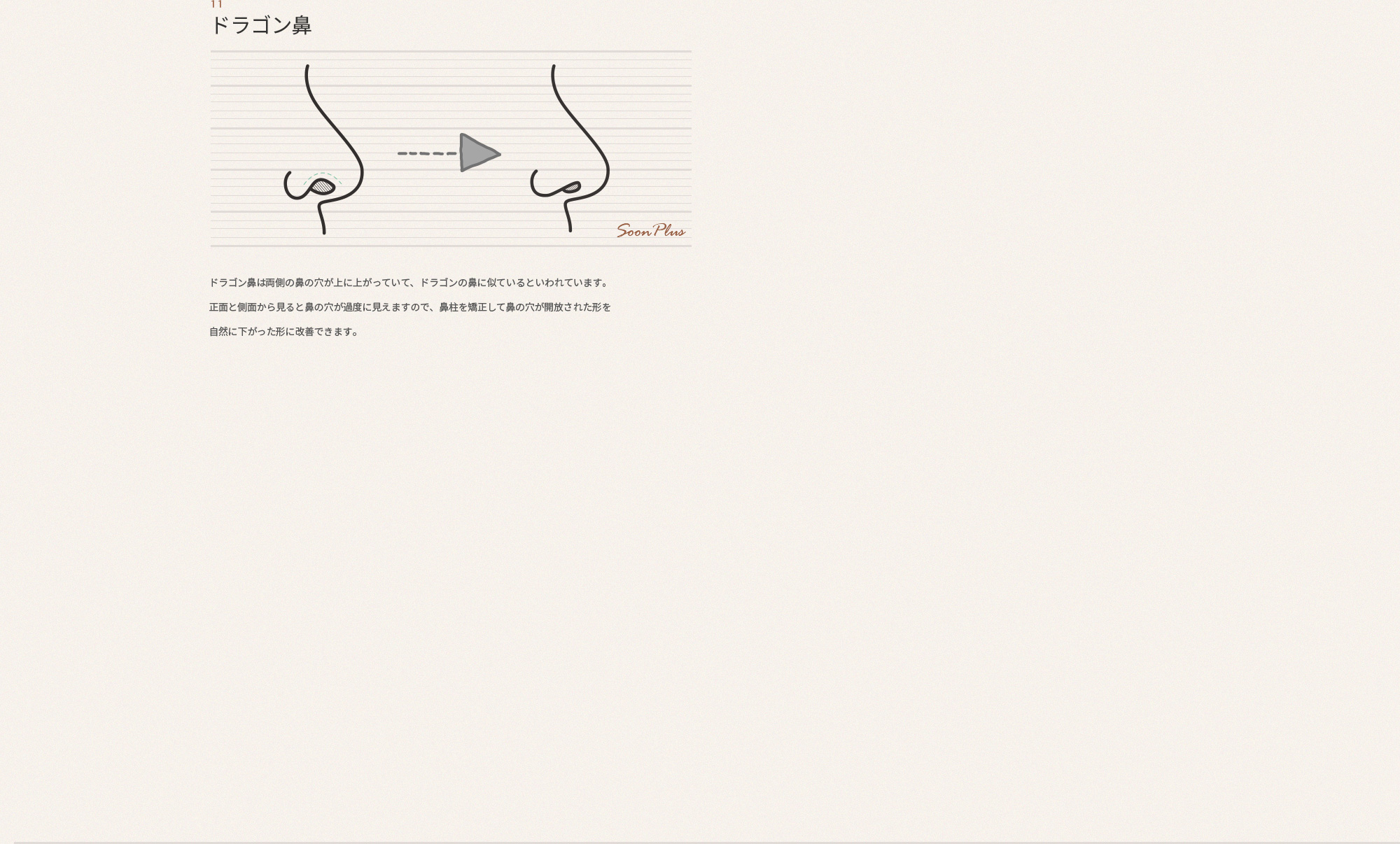 11 용코