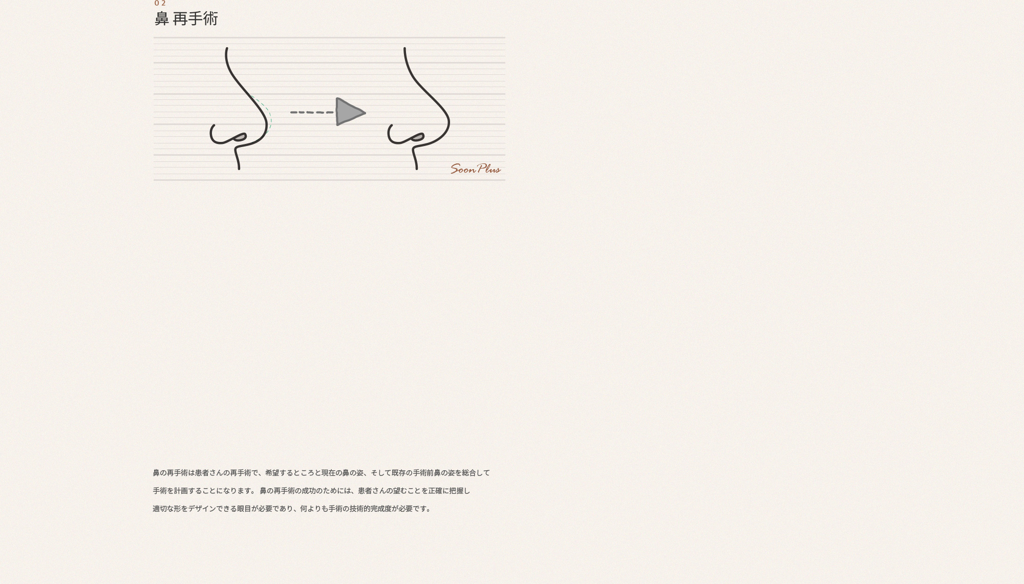02 코재수술